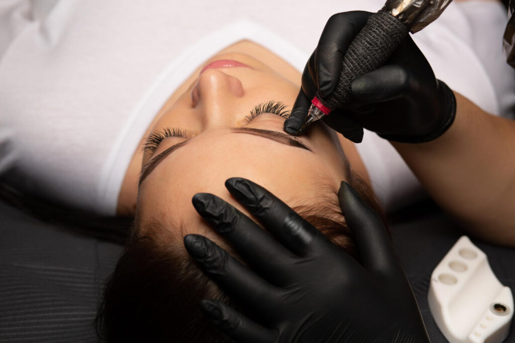 Tattoo Removal Sessions